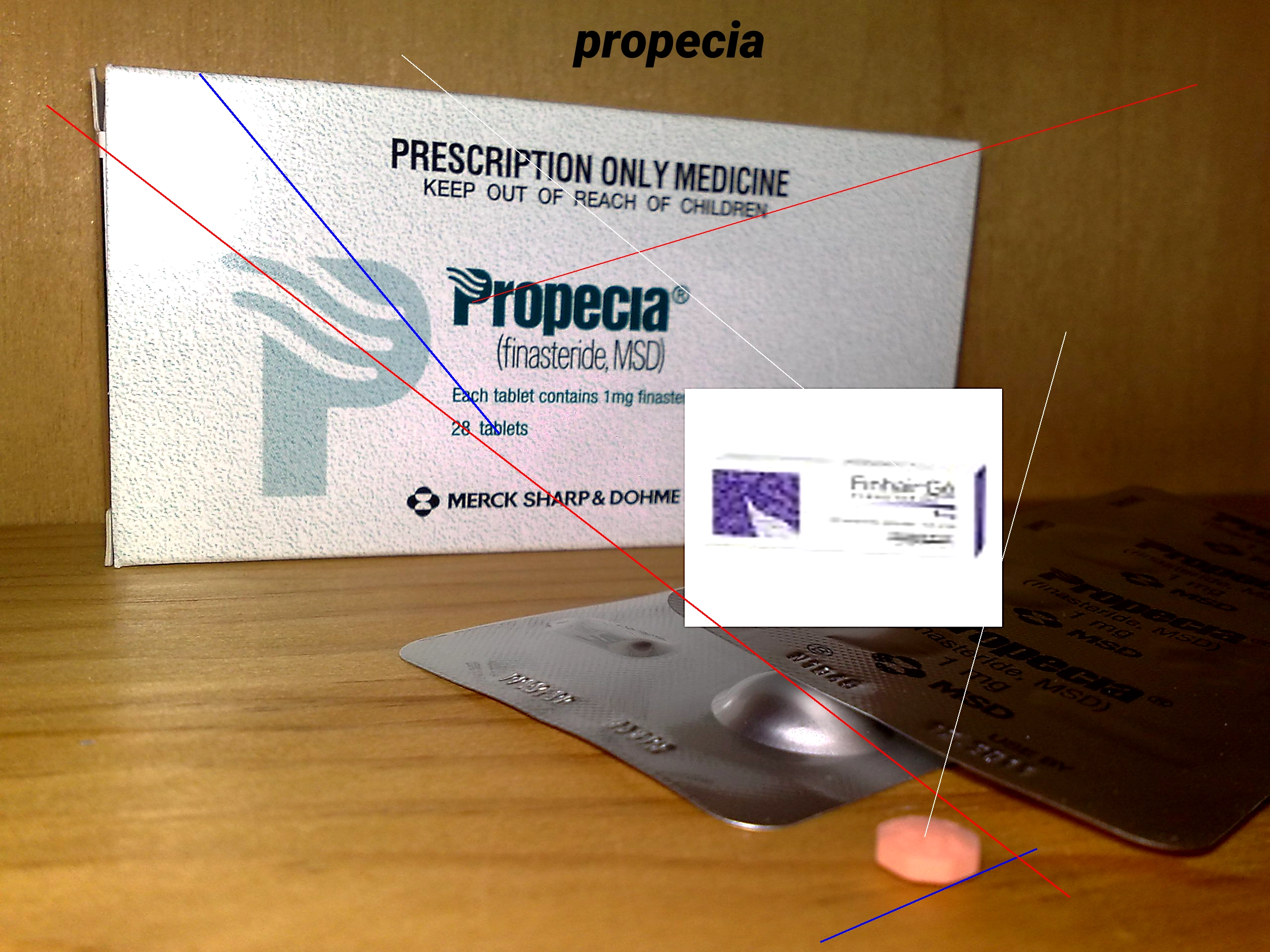 Achat finasteride propecia